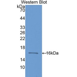 CD59 Glycoprotein (CD59) Antibody