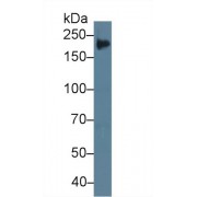 Western blot analysis of Rat Placenta lysate, using Rat TNC Antibody (1 µg/ml) and HRP-conjugated Goat Anti-Rabbit antibody (<a href="https://www.abbexa.com/index.php?route=product/search&amp;search=abx400043" target="_blank">abx400043</a>, 0.2 µg/ml).