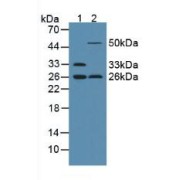 abx100431