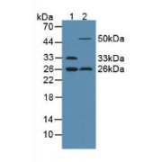 Western blot analysis of (1) Rat Serum and (2) Rat Uterus Tissue.