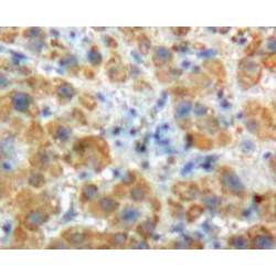 Angiostatin Antibody