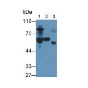 WB analysis of Human serum (lane 1), Human lung lysate (lane 2) and Rat serum (lane 3) using Antithrombin-III (SERPINC1) antibody (3 µg/ml) and HRP-conjugated Goat Anti-Mouse antibody (<a href="https://www.abbexa.com/index.php?route=product/search&amp;search=abx400001" target="_blank">abx400001</a>, 0.2 µg/ml).