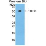 Western blot analysis of recombinant Mouse Antithrombin Protein.