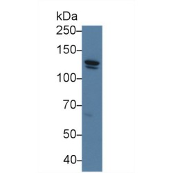 Cadherin 5 (CDH5) Antibody