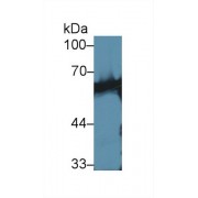 Western blot analysis of Mouse Skeletal muscle lysate, using Human CaN Antibody (1 µg/ml) and HRP-conjugated Goat Anti-Rabbit antibody (<a href="https://www.abbexa.com/index.php?route=product/search&amp;search=abx400043" target="_blank">abx400043</a>, 0.2 µg/ml).