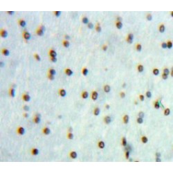 Serine/Threonine-Protein Phosphatase 2B Catalytic Subunit Alpha Isoform (PPP3CA) Antibody