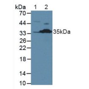 Western blot analysis of (1) Human Jurkat Cells and (2) Mouse Kidney Tissue.