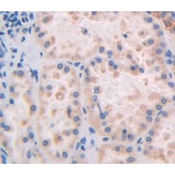 Caspase 2 (CASP2) Antibody