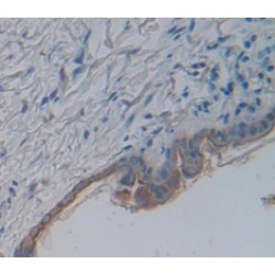 Caveolin 1 (CAV1) Antibody