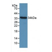 Western blot analysis of recombinant Chicken CCND1.