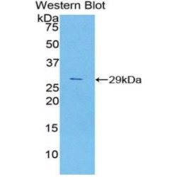 G1/S-Specific Cyclin-D2 (CCND2) Antibody