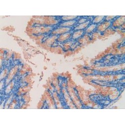 G1/S-Specific Cyclin-D2 (CCND2) Antibody