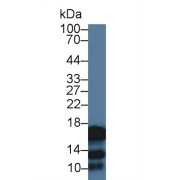 Western blot analysis of Human Saliva, using Human CST2 Antibody (3 µg/ml) and HRP-conjugated Goat Anti-Rabbit antibody (<a href="https://www.abbexa.com/index.php?route=product/search&amp;search=abx400043" target="_blank">abx400043</a>, 0.2 µg/ml).