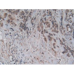 Cystatin C (CST3) Antibody
