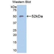 Western blot analysis of the recombinant protein.