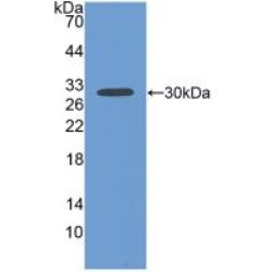 Fibulin 1 (FBLN1) Antibody
