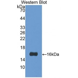 Galectin 1 (LGALS1) Antibody