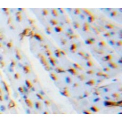 Galectin 1 (LGALS1) Antibody