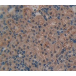 Galectin 9 (LGALS9) Antibody