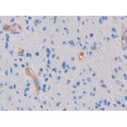 Glycocalicin (GC) Antibody