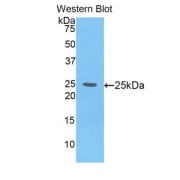 Western blot analysis of recombinant Mouse GPC4 Protein.