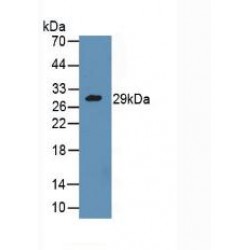 Granzyme A (GZMA) Antibody