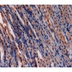 Gremlin 1 (GREM1) Antibody