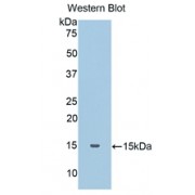 Western blot analysis of recombinant Human HP Protein.