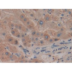 Haptoglobin Alpha Chain (HP) Antibody