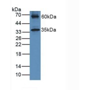 Western blot analysis of Mouse Heart Tissue.