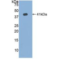 Hemojuvelin (HJV) Antibody