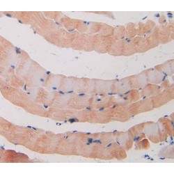 Klotho Beta (KLb) Antibody