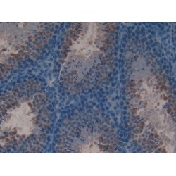 Lactoferrin (LTF) Antibody