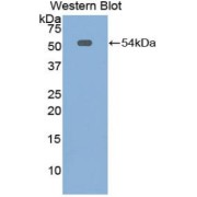 Western blot analysis of the recombinant protein.