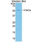 Western blot analysis of recombinant Mouse MSLN, using MSLN antibody.