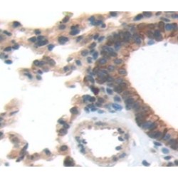Mesothelin (MSLN) Antibody