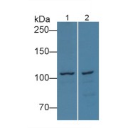 WB analysis of Rat liver (1) and cerebrum (2) tissue lysates using Myosin ID (MYO1D) Antibody (1 µg/ml) and HRP-conjugated Goat Anti-Rabbit antibody (<a href="https://www.abbexa.com/index.php?route=product/search&amp;search=abx400043" target="_blank">abx400043</a>, 0.2 µg/ml).