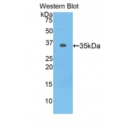 Western blot analysis of recombinant Human MYO1F Protein.