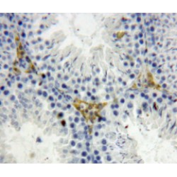 Osteoglycin (OGN) Antibody