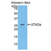Western blot analysis of the recombinant protein.