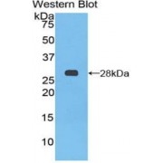 Western blot analysis of recombinant Mouse PTCH1 Protein.