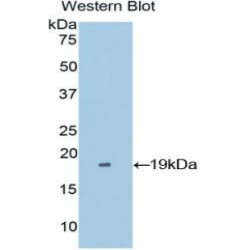 Periostin (POSTN) Antibody