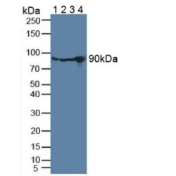 Plasminogen (PLG) Antibody