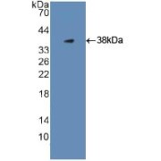 Western blot analysis of recombinant Human PLG.