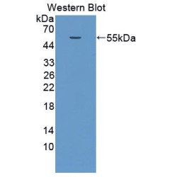 Podocalyxin (PODXL) Antibody