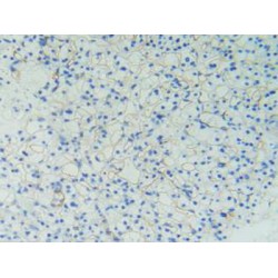 Podocalyxin (PODXL) Antibody