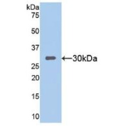 Sirtuin 1 (SIRT1) Antibody