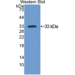 NAD-Dependent Protein Deacetylase Sirtuin-2 (SIRT2) Antibody