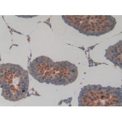 NAD-Dependent Protein Deacetylase Sirtuin-2 (SIRT2) Antibody