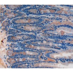 NAD-Dependent Protein Deacetylase Sirtuin-2 (SIRT2) Antibody